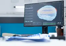 Axoft набра 55 милиона долара за развитие на невротехнологииАмериканската компания