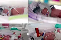 1 на 15 милиона: Австралийка роди еднояйчни четиризнаци