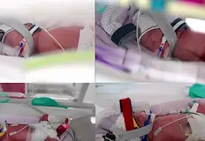 Рядкото събитие изненада лекаритеВ Кралската болница в Бризбейн се родиха