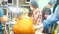 Лекари отстраниха 27-килограмов тумор от корема на жена