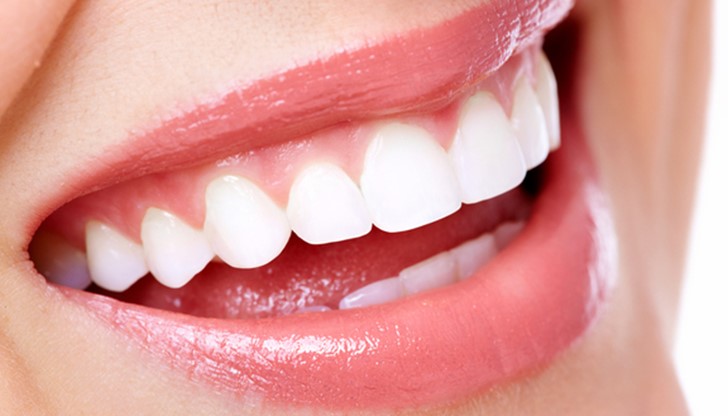 Когато плаката се натрупа върху зъбите за дълго време, под влияние на минерали от слюнката, се образува зъбен камък