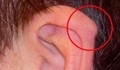 Имате ли тази необикновена издатина на ухото?