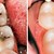 8 начина да спрем развалянето на зъбите