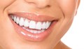 Избелването на зъбите води до появата на кариеси