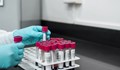 Лаборанти: Ако имате под 500 единици антитела, ваксинирайте се