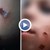 Разследват изгаряния от цигара по лицето на малко момче от Кърджали
