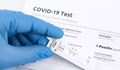 Под 2% паднаха положителните проби за COVID-19 у нас