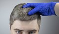 Ранното побеляване на косата може да е сигнал за атеросклероза