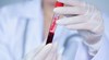 Учени са напът да изобретят универсална нулева кръвна група