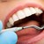 Учените тестват лекарство за израстване на нови зъби